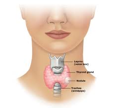 Thyroid Lumps (Nodules)
